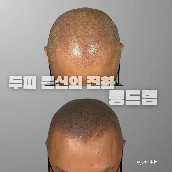 삭발데모 모셔요 - 5번째 이미지