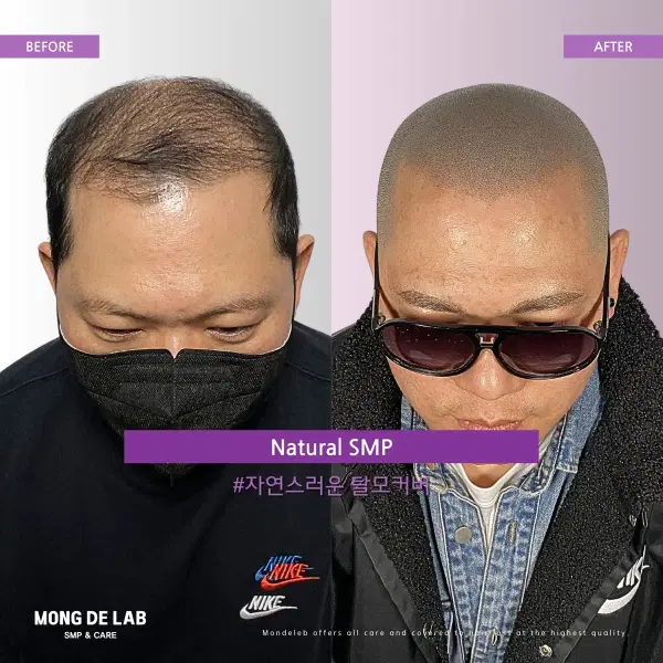 삭발데모 모셔요 - 4번째 이미지